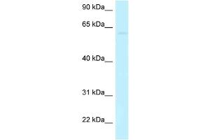 WB Suggested Anti-CCDC105 Antibody Titration: 1. (CCDC105 antibody  (C-Term))