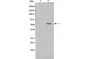 Western blot analysis on 293 cell lysate using THR1 Antibody (THRB antibody  (Internal Region))