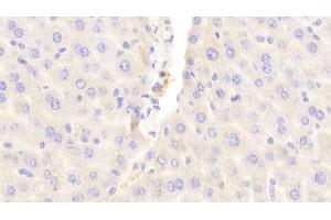 Detection of ABCC6 in Mouse Liver Tissue using Polyclonal Antibody to ATP Binding Cassette Transporter C6 (ABCC6) (ABCC6 antibody  (AA 1260-1498))