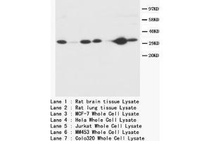 Western blot Caspase-3 (P10) Polyclonal Antibody (Caspase 3 antibody  (C-Term))