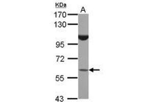 Image no. 1 for anti-BTB (POZ) Domain Containing 16 (BTBD16) (AA 1-255) antibody (ABIN1496968) (BTBD16 antibody  (AA 1-255))