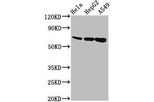 Western Blot Positive WB detected in: Hela whole cell lysate, HepG2 whole cell lysate, A549 whole cell lysate All lanes: MUC20 antibody at 5. (MUC2 antibody  (AA 569-657))