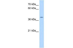 ApoBEC3B antibody used at 0.