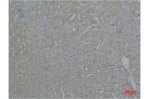 Immunohistochemistry (IHC) analysis of paraffin-embedded Mouse Kidney Tissue using ZBTB45 Polyclonal Antibody.