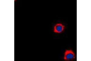 Immunofluorescent analysis of CD40 staining in A431 cells. (CD40 antibody  (C-Term))