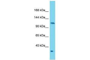 Western Blotting (WB) image for anti-Protein Kinase N2 (PKN2) (C-Term) antibody (ABIN2788942) (PKN2 antibody  (C-Term))