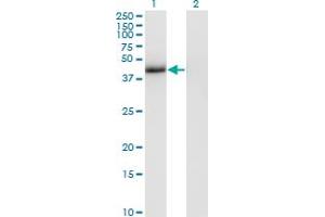 Western Blot analysis of T expression in transfected 293T cell line by T monoclonal antibody (M02), clone 5C5. (T Brachyury Protein (AA 222-320) antibody)