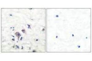 Immunohistochemical analysis of paraffin-embedded human brain tissue using GluR2/3 antibody. (Metabotropic Glutamate Receptor 3 antibody)