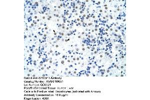 Immunohistochemistry (IHC) image for anti-Sterol Regulatory Element Binding Transcription Factor 1 (SREBF1) (Middle Region) antibody (ABIN2792233)