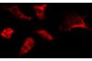 ABIN6278190 staining HepG2 by IF/ICC. (BORA antibody  (C-Term))