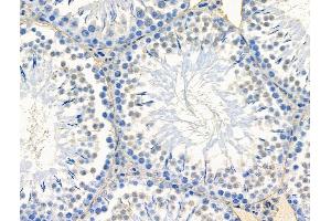 ABIN7094569 and ABIN7098618 at 1/100 staining Rat testis tissue by IHC-P.