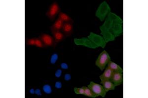 ABIN6255135 and ABIN6267411 staining Hela cells(24h of starvation treatment) by IF/ICC.