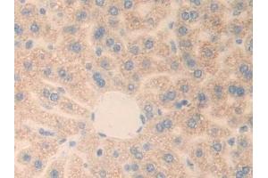 Detection of PLXNB1 in Mouse Liver Tissue using Polyclonal Antibody to Plexin B1 (PLXNB1) (PLXNB1 antibody  (AA 1598-1849))