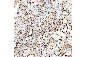 IHC analysis of SNRNP40 using anti-SNRNP40 antibody (ABIN7601719).