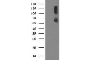 Image no. 1 for anti-Protein Phosphatase, Mg2+/Mn2+ Dependent, 1G (PPM1G) antibody (ABIN1500378) (PPM1G antibody)
