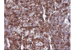 Immunohistochemistry (IHC) image for anti-T-cell surface glycoprotein CD1c (CD1C) antibody (ABIN2670659) (CD1c antibody)