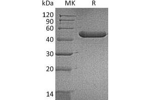 Western Blotting (WB) image for Chitinase 3-Like 3 (CHI3L3) (Pro105Ser-Mutant) protein (His tag) (ABIN7320844) (CHI3L3 Protein (Pro105Ser-Mutant) (His tag))