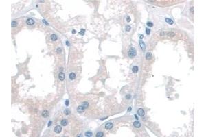 Detection of KATNA1 in Human Kidney Tissue using Polyclonal Antibody to Katanin P60 Subunit A 1 (KATNA1) (KATNA1 antibody  (AA 8-229))