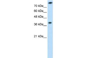 WB Suggested Anti-TST Antibody  Titration: 1 ug/ml Positive Control: Jurkat cell lysate