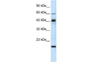 WB Suggested Anti-ZNF24 Antibody Titration:  0. (ZNF24 antibody  (Middle Region))