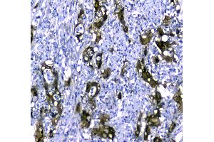 IHC analysis of STUB1 using anti-STUB1 antibody . (STUB1 antibody  (AA 51-303))