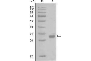 Western blot analysis using PAR1 mouse mAb against truncated GST-PAR1 recombinant protein (1). (PAR1 antibody)
