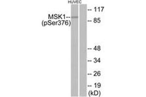 Western blot analysis of extracts from HuvEc cells treated with PMA 125ng/ml 30', using MSK1 (Phospho-Ser376) Antibody. (MSK1 antibody  (pSer376))