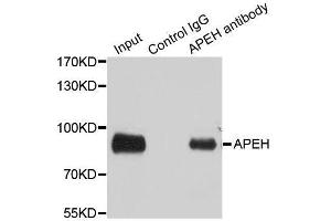 Immunoprecipitation analysis of 100ug extracts of SW480 cells using 3ug APEH antibody.