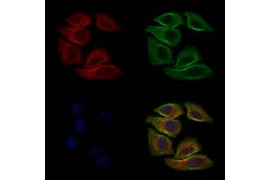 ABIN6264322 and ABIN6277635 staining Hela cells by IF/ICC.