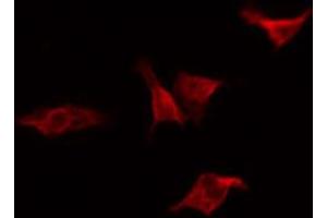 ABIN6267229 staining 293 by IF/ICC. (IKK alpha antibody  (pThr23))