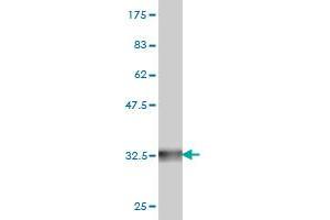 Western Blot detection against Immunogen (31.