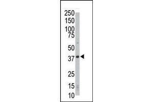 Western blot analysis of anti-CDK4 Pab (ABIN391751 and ABIN2841625) in HL-60 cell lysate. (CDK4 antibody  (C-Term))