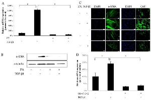 Immunofluorescence (IF) image for anti-Collagen, Type I (COL1) antibody (ABIN5596819)