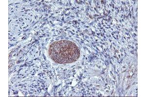 Image no. 2 for anti-1-Acylglycerol-3-Phosphate O-Acyltransferase 5 (Lysophosphatidic Acid Acyltransferase, Epsilon) (AGPAT5) antibody (ABIN1496497) (AGPAT5 antibody)