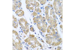 Immunohistochemistry of paraffin-embedded human gastric using EIF2S3 antibody at dilution of 1:100 (x40 lens). (EIF2S3 antibody)