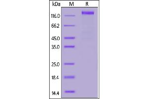 SARS-CoV-2 S1 protein, Fc Tag on SDS-PAGE under reducing (R) condition. (SARS-CoV-2 Spike S1 Protein (Fc Tag))