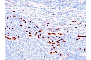 Formalin-fixed, paraffin-embedded human Tonsil stained with Macrophage L1 Protein Mouse Monoclonal Antibody (MAC387) (S100A8 antibody)