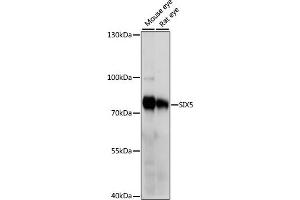 Western blot analysis of extracts of various cell lines, using SIX5 antibody (ABIN7267777) at 1000 dilution. (Six5 antibody  (AA 1-170))