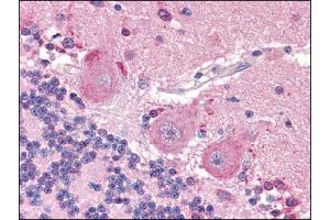 Image no. 1 for anti-Solute Carrier Family 6 (Neurotransmitter Transporter, Dopamine), Member 3 (SLC6A3) (N-Term) antibody (ABIN372309)