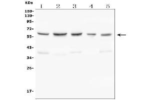 Western blot analysis of C9ORF72 using anti-C9ORF72 antibody (ABIN7603124). (C9ORF72 antibody  (N-Term))