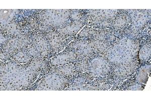 IHC analysis of CDC45L using anti-CDC45L antibody (ABIN7600230). (CDC45 antibody  (AA 166-431))