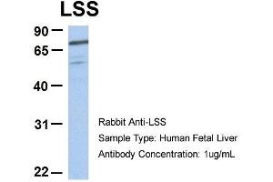 Host:  Rabbit  Target Name:  RIOK3  Sample Type:  Human Fetal Heart  Antibody Dilution:  1. (RIOK3 antibody  (C-Term))