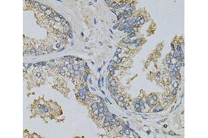 Immunohistochemistry of paraffin-embedded Human prostate using PSAT1 Polyclonal Antibody at dilution of 1:100 (40x lens). (PSAT1 antibody)