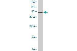 Western Blot detection against Immunogen (52. (MTUS1 antibody  (AA 1-240))