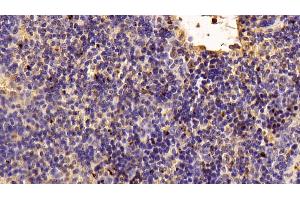 Detection of TIGIT in Mouse Spleen Tissue using Polyclonal Antibody to T-Cell Immunoreceptor With Ig And ITIM Domains Protein (TIGIT) (TIGIT antibody  (AA 28-246))