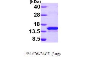 SDS-PAGE (SDS) image for Selenoprotein X, 1 (SEPX1) (AA 1-116) protein (His tag) (ABIN667227)