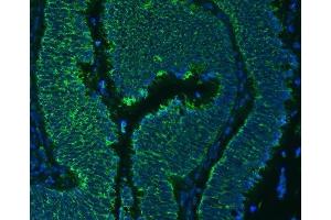 IF analysis of SLC25A24 using anti-SLC25A24 antibody (ABIN7599228).