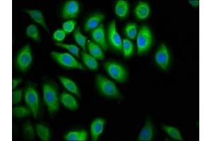 Immunofluorescence staining of A549 cells with ABIN7174093 at 1:100, counter-stained with DAPI. (PTPN13 antibody  (AA 1965-2173))