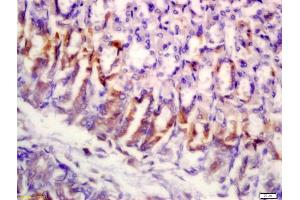 Formalin-fixed and paraffin embedded mouse stomach labeled with Anti-SLAMF7/CD319/CS1 Polyclonal Antibody, Unconjugated (ABIN741825) at 1:200 followed by conjugation to the secondary antibody and DAB staining (SLAMF7 antibody  (AA 51-160))