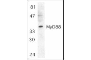 Western blot analysis of MyD88 in Jurkat whole cell lysate with this product at 1:500 dilution. (MYD88 antibody  (C-Term))